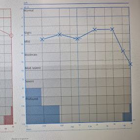 MW Hearing Test